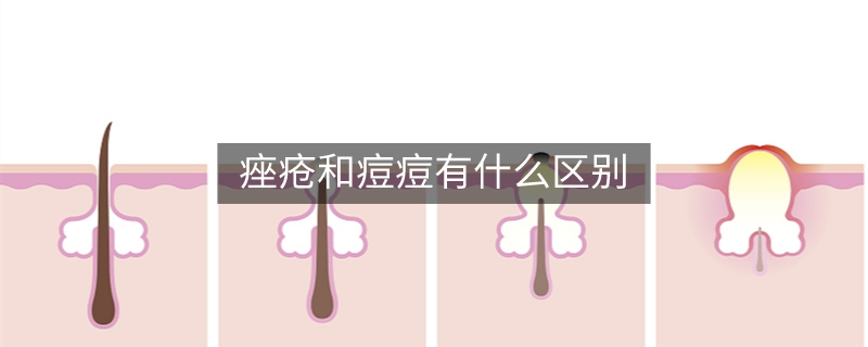痤瘡和痘痘有什么區(qū)別