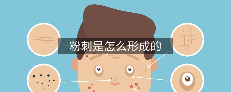 粉刺是怎么形成的 粉刺是怎么形成的