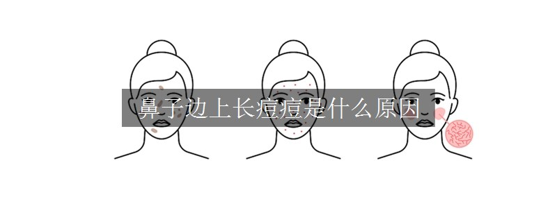 鼻子邊上長痘痘是什么原因