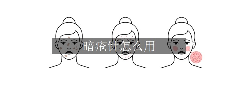 暗瘡針怎么用