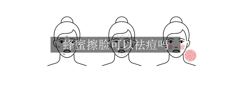 蜂蜜擦臉可以祛痘嗎