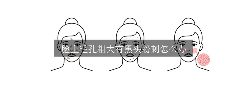臉上毛孔粗大有黑頭粉刺怎么辦