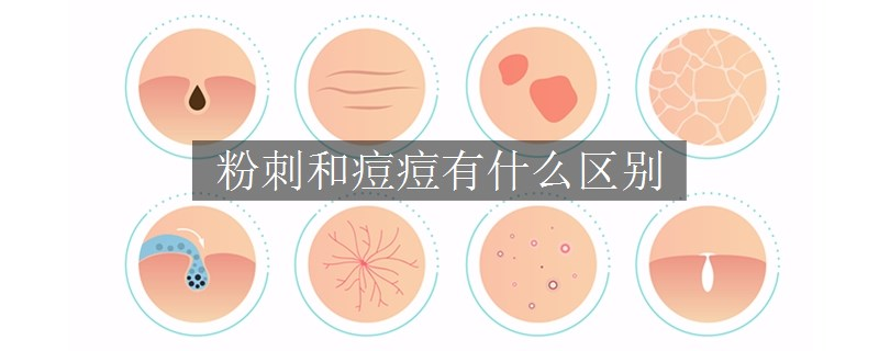 粉刺和痘痘有什么區(qū)別