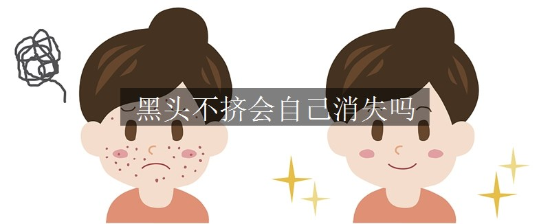 黑頭不擠會(huì)自己消失嗎