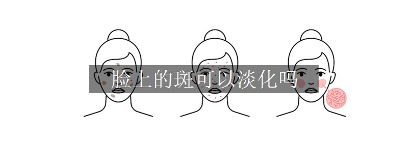臉上的斑可以淡化嗎