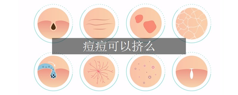 痘痘可以擠么