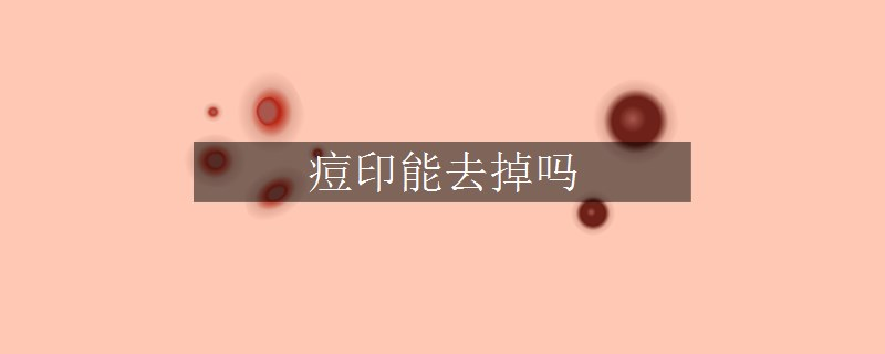 痘印能去掉嗎