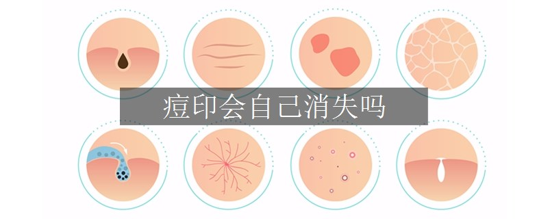 痘印會(huì)自己消失嗎