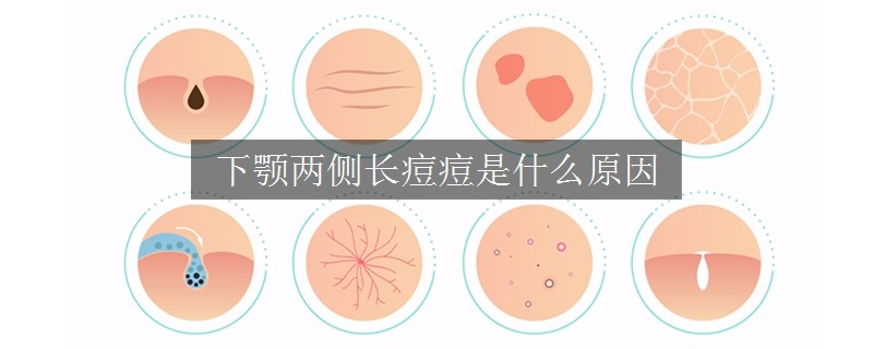 下顎兩側(cè)長痘痘是什么原因