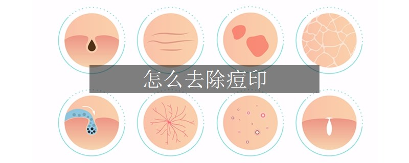 怎么去除痘印
