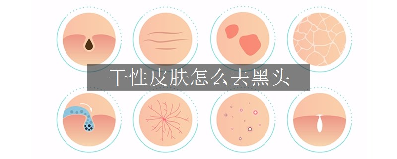 干性皮膚怎么去黑頭