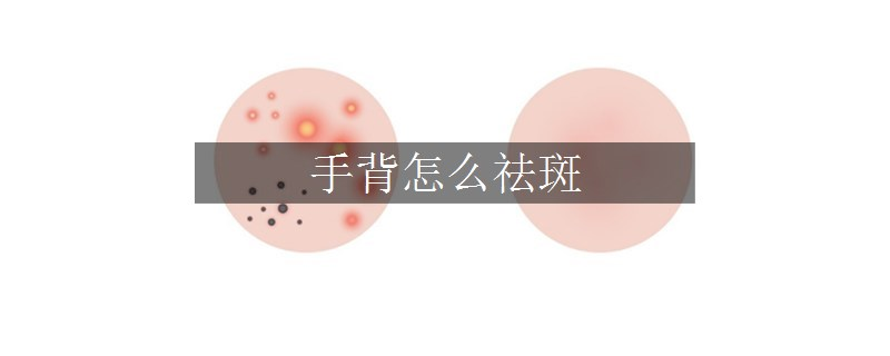 手背怎么祛斑