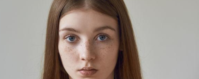 女孩臉上有雀斑怎么辦 女孩臉上有雀斑怎么辦