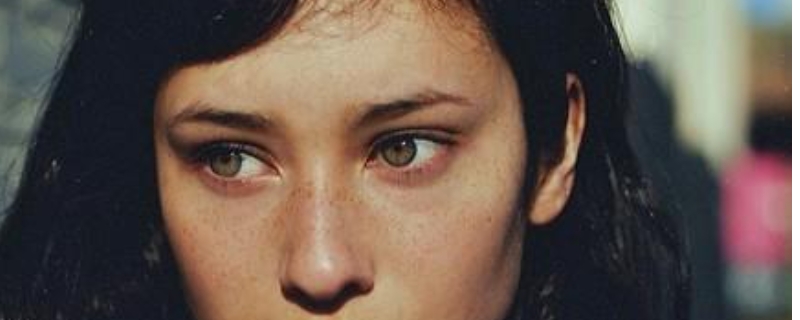 女孩臉上有雀斑怎么辦 女孩臉上有雀斑怎么辦